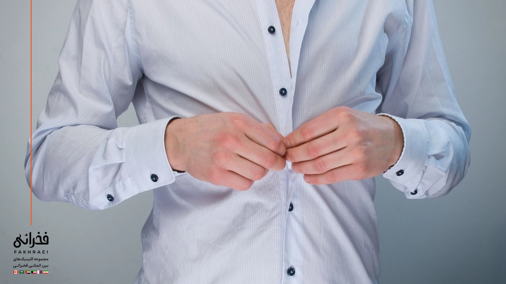 لباس راحت بعد از کاشت مو