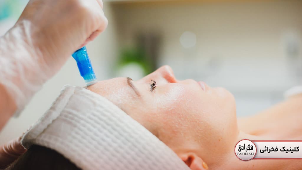 مزیتها و معایب میکرونیدلینگ