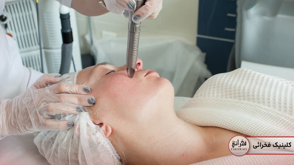 جوانسازی پوست با لیزر