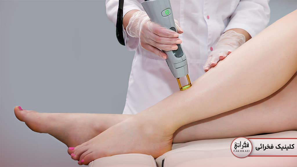 دستگاه لیزر مو‌های زائد کندلا