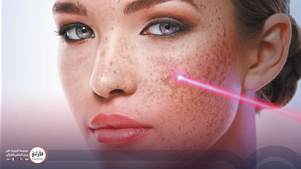 فرایند انجام لیزر CO2