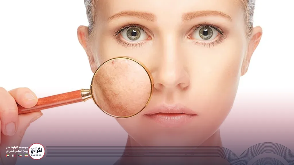 عکس دختری در حال بررسی پوست خود با ذره بین