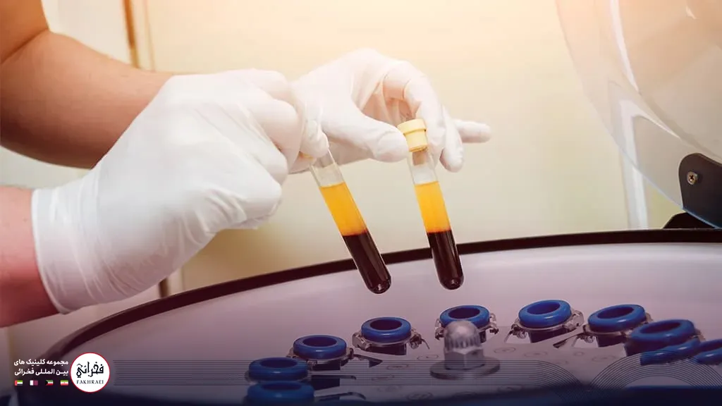 کیت پی آر پی در دستگاه سانتریفیوژ