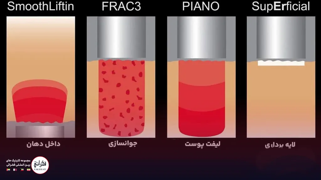 تصویر لیزر فوتونا روی پوست صورت از زاویه های مختلف