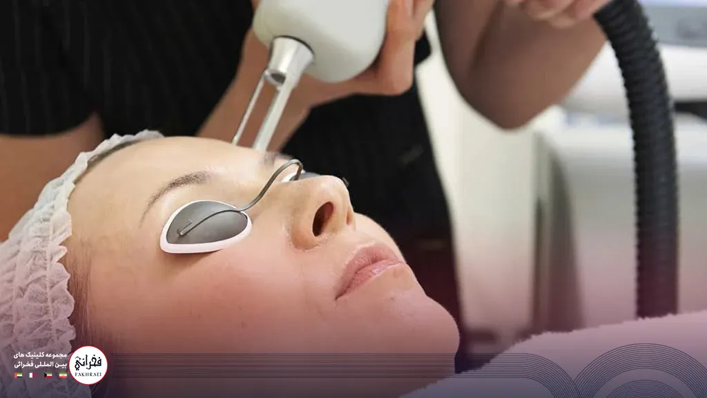 کاربرد لیزر CO2 فرکشنال