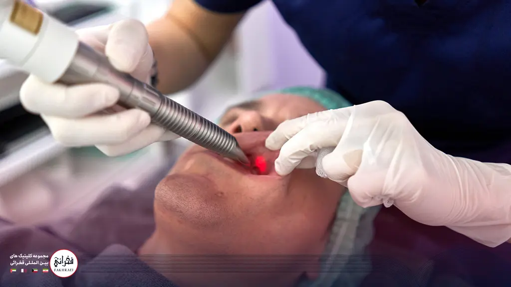 انجام لیزر فوتونا از داخل دهان