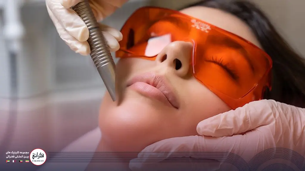 انجام لیزر فوتونا