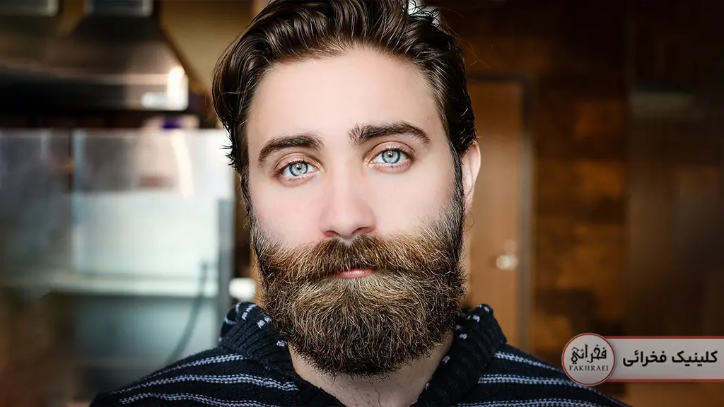 فردی زیبا رو با ریش که کوسه نیست