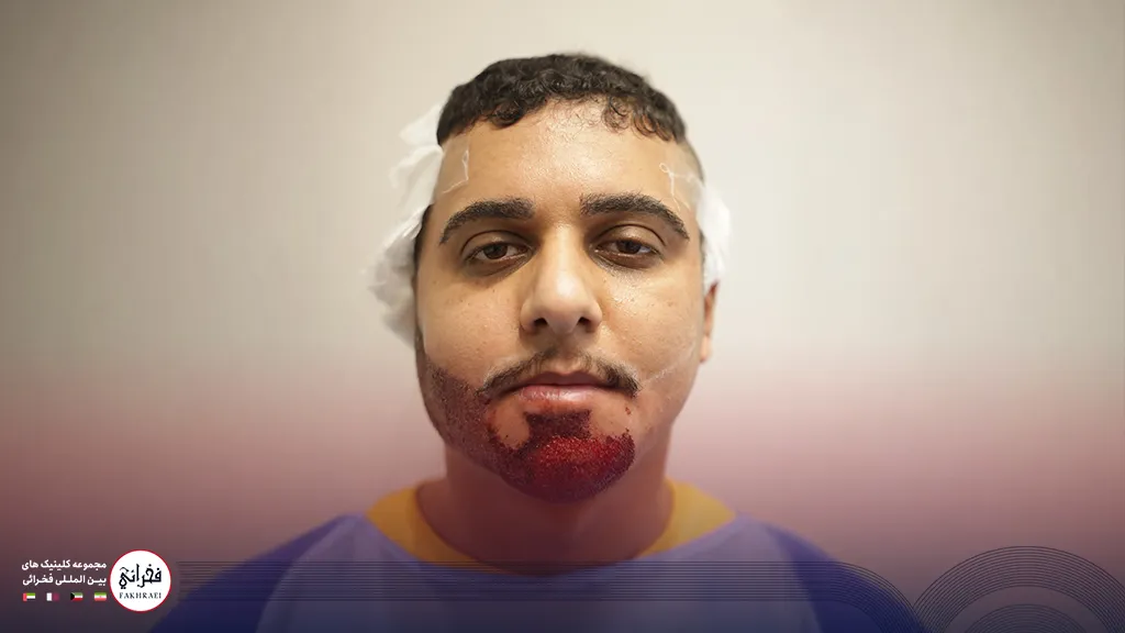 کاشت ریش در کلینیک فخرائی