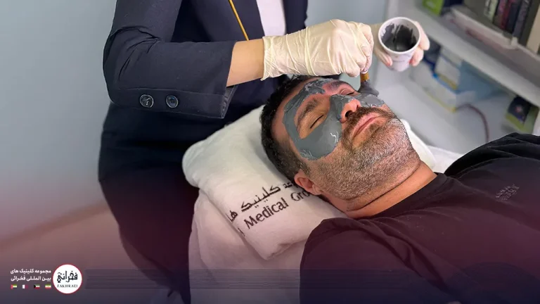 فیشیال آقایان