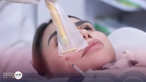 پی آر پی صورت