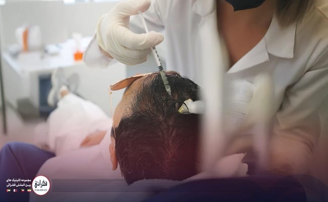 پی آر پی (prp) چیست؟ و چه کاربردی در زیبایی دارد؟