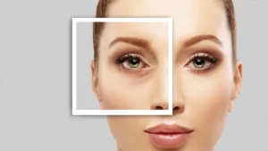 تزریق چربی زیر چشم