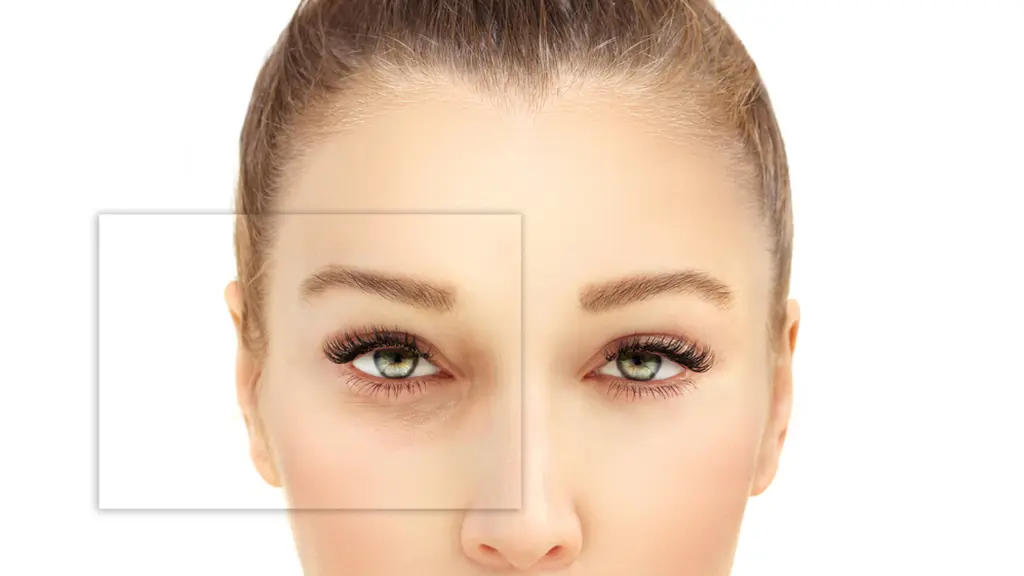 مراقبتهای ضروری بعد از تزریق چربی