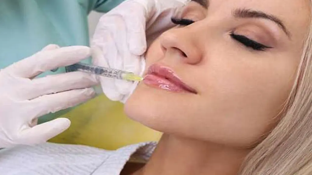 تزریق چربی توسط دکتر به لب