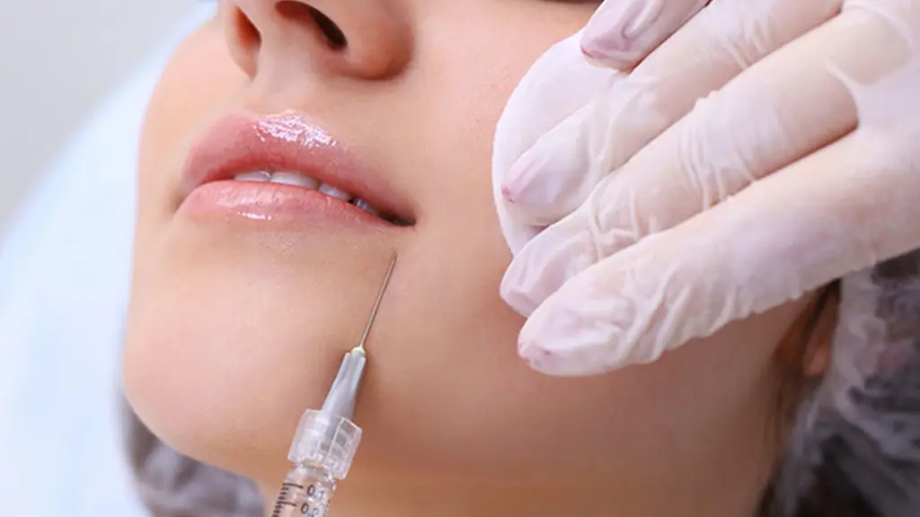 نحوه تزریق فیلر خط خنده