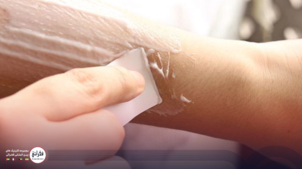 آیا استفاده از بلیچینگ توصیه می‌شود؟