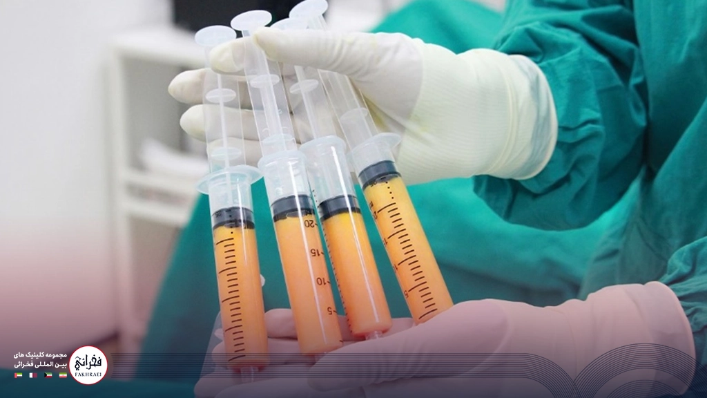 تزریق چربی به شقیقه-سرنگ های چربی