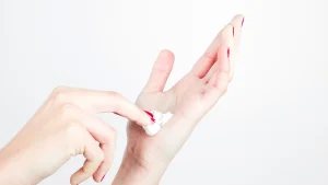 تزریق ژل دست