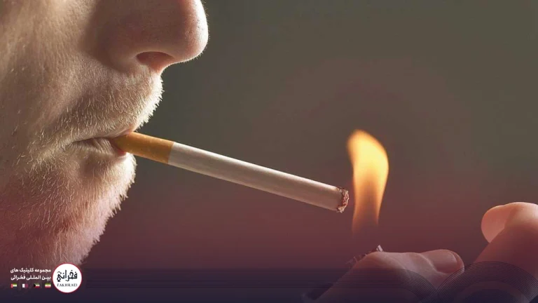 سیگار بعد از کاشت مو