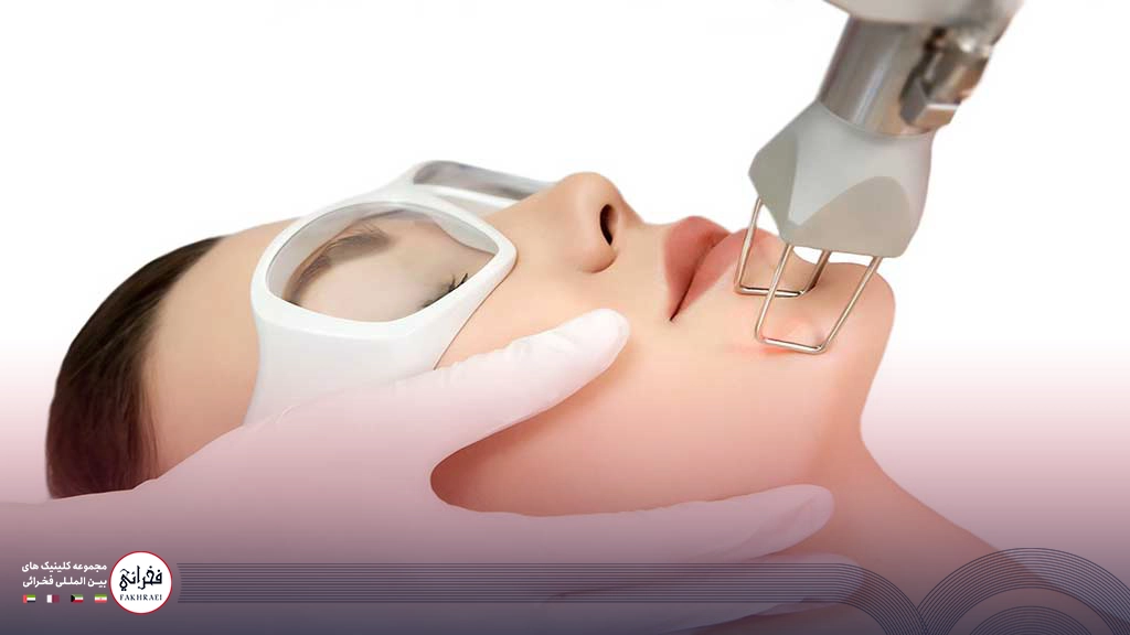 هزینه لیزر فرکشنال co2