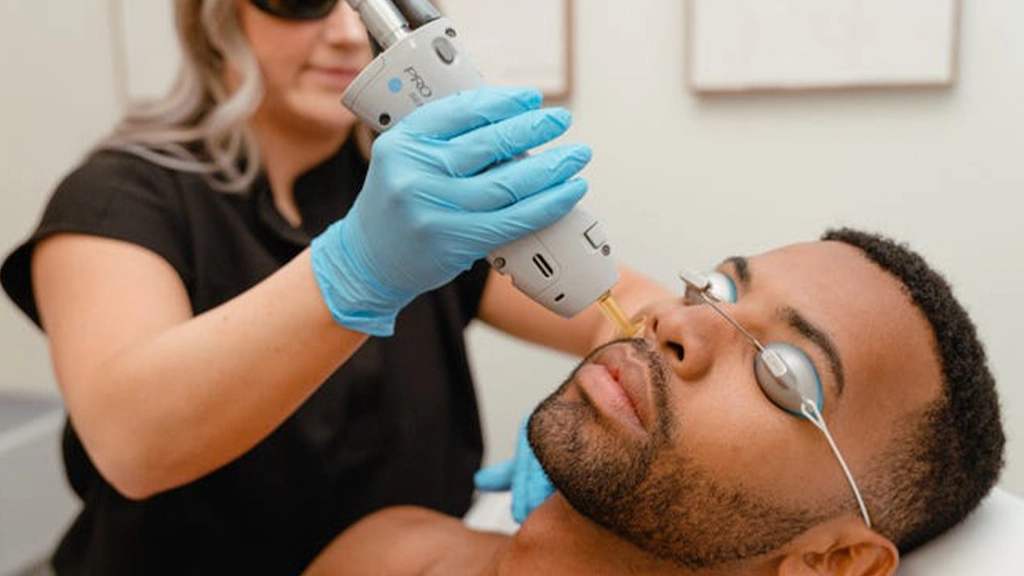 لیزر موی صورت