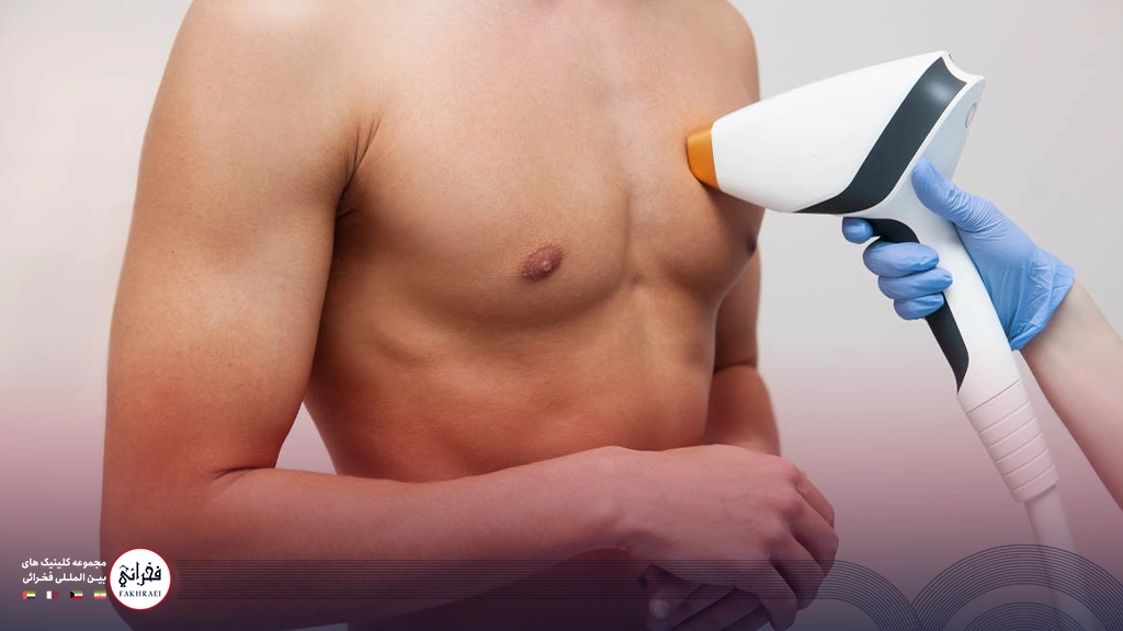 لیزر موهای زائد سینه مردان