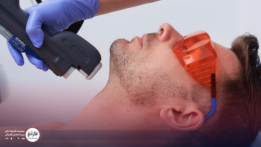 لیزر موهای زائد صورت مردان