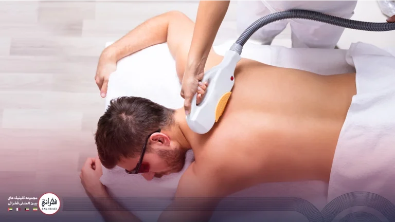 لیزر موهای زائد مردان