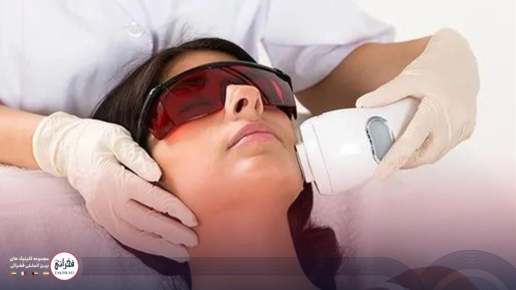لیزر موهای زائد زیر گلو