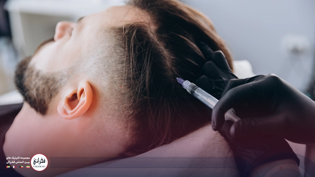 ماندگاری مزوتراپی مو