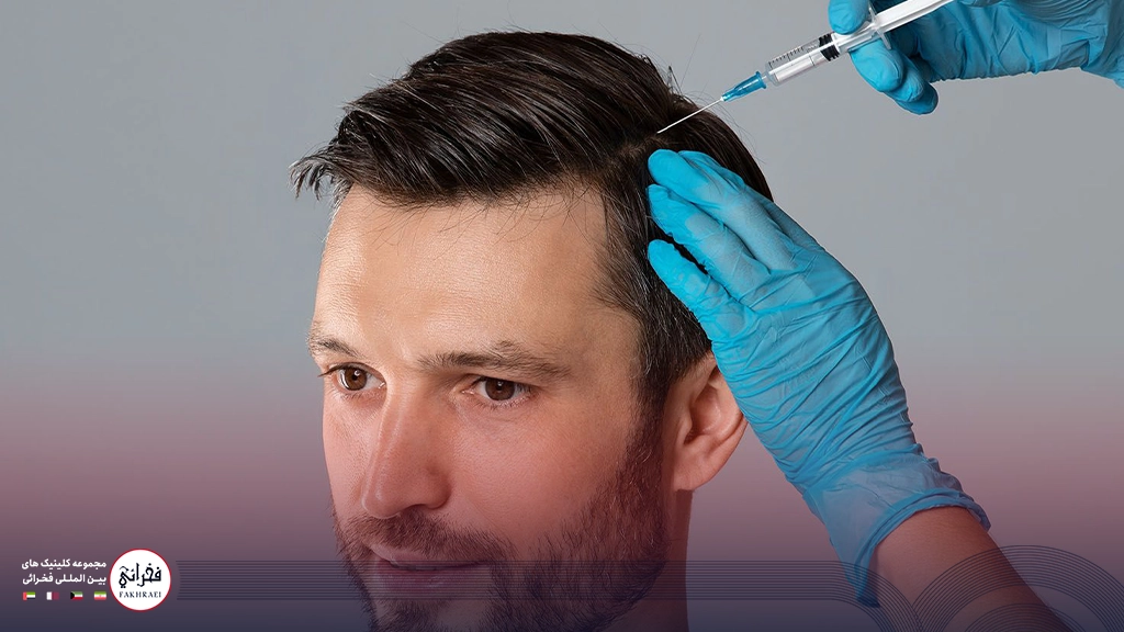 نواحی تزریق در مزوتراپی مو