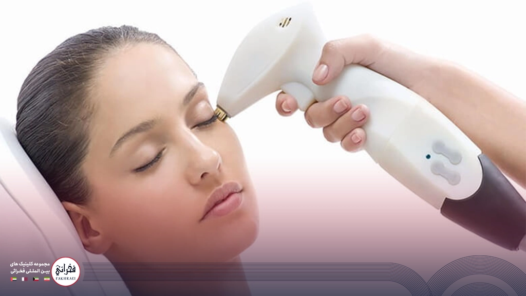 هایفوتراپی صورت-در حال انجام هایفو روی صورت خانمی