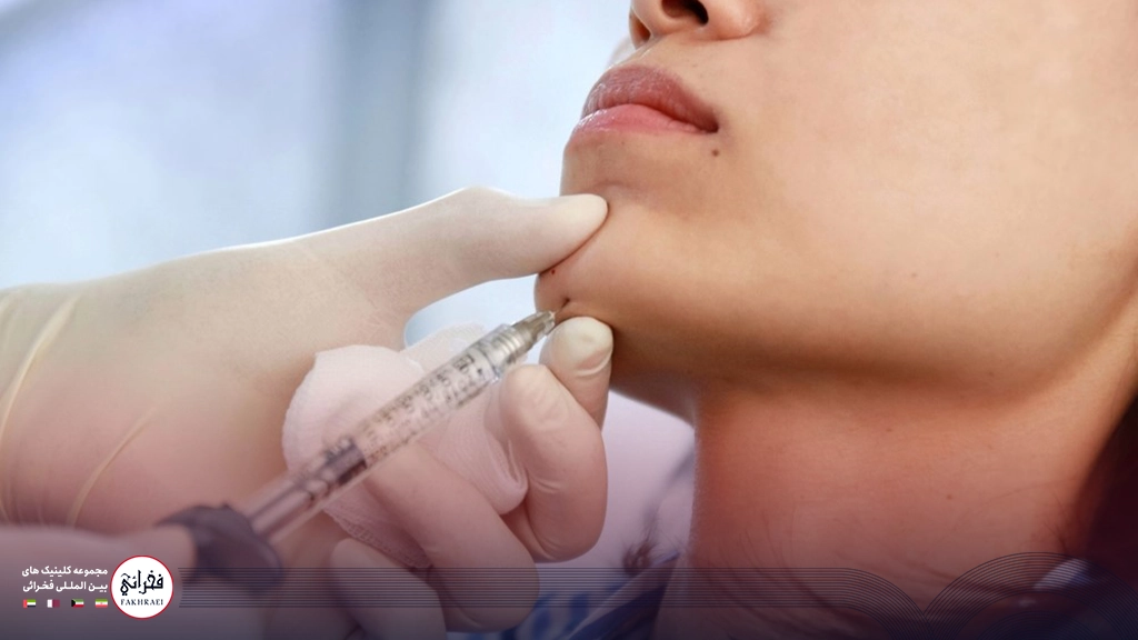 تزریق ژل به چانه