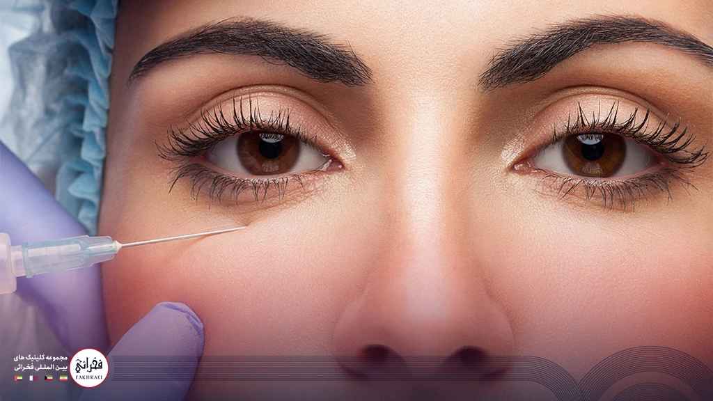 تزریق ژل به زیر چشم