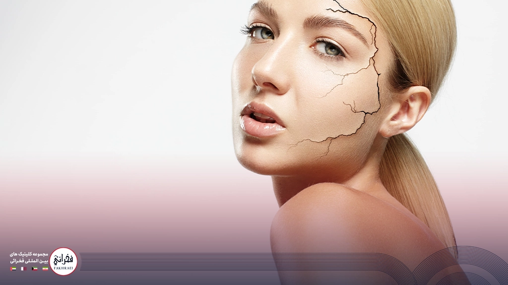 لیفت شقیقه با نخ-خانومی با موی بلوند و پوست ترک خورده