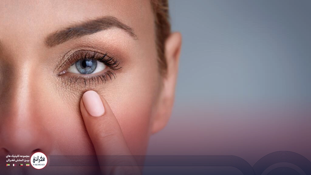 مزوتراپی زیر چشم-خانومی با چشمان آبی که انگشتش را زیر چشمش قرار داده