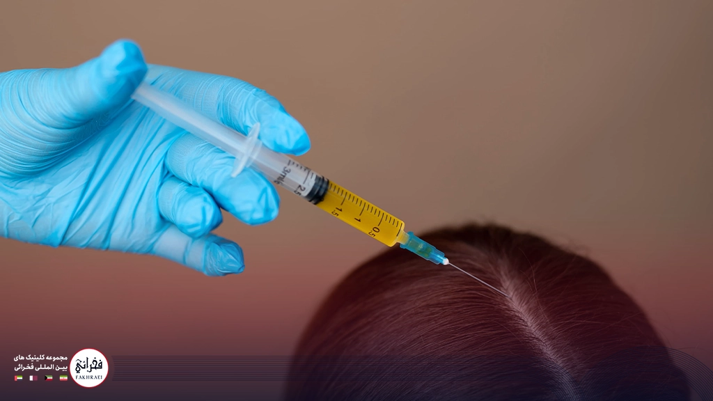 پی‌ آر پی مو-تزریق به کف سر خانومی