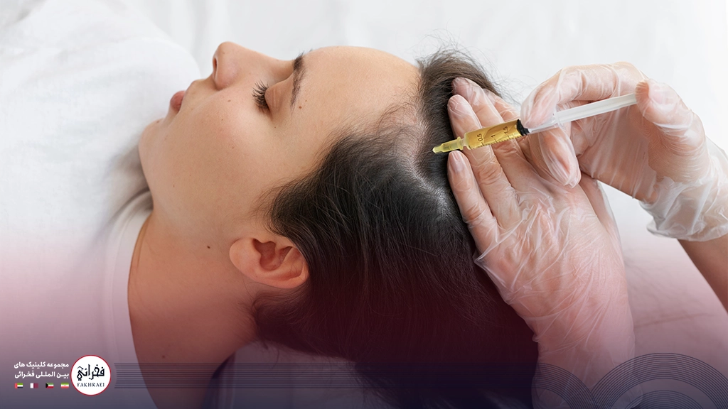 پی‌ آر پی مو-تزریق به کف سر خانومی