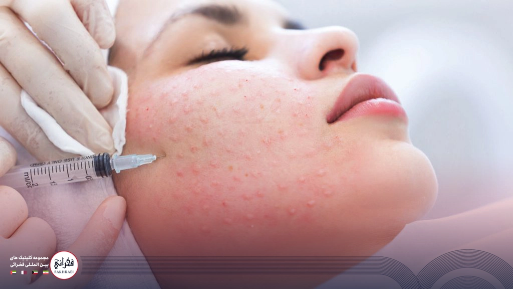 بهترین مزوژل صورت