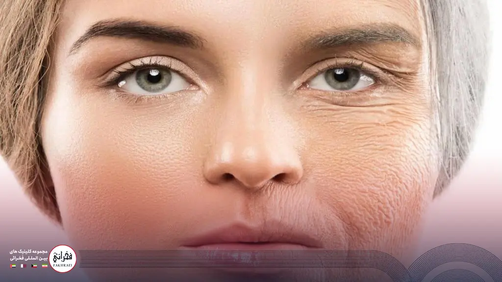 قبل و بعد از جوانسازی صورت