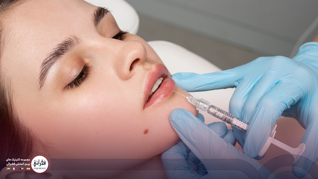 تزریق ژل لب نچرال-در حال تزریق ژل لب