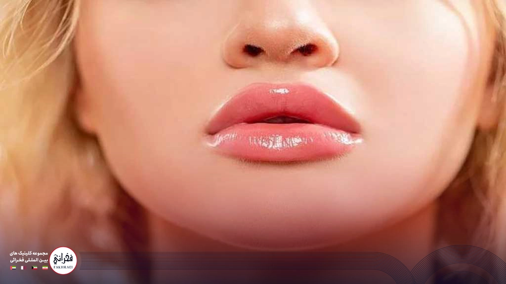 تزریق ژل لب عروسکی -لب های عروسکی خانمی