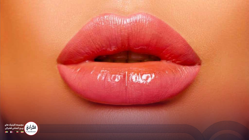تزریق ژل لب مدل چاک دار -لب های چاک دار خانمی