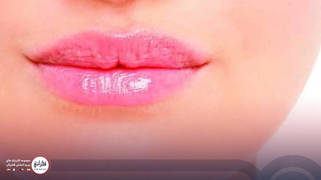 تزریق ژل لب مدل چاک دار -لب های صورتی خانمی