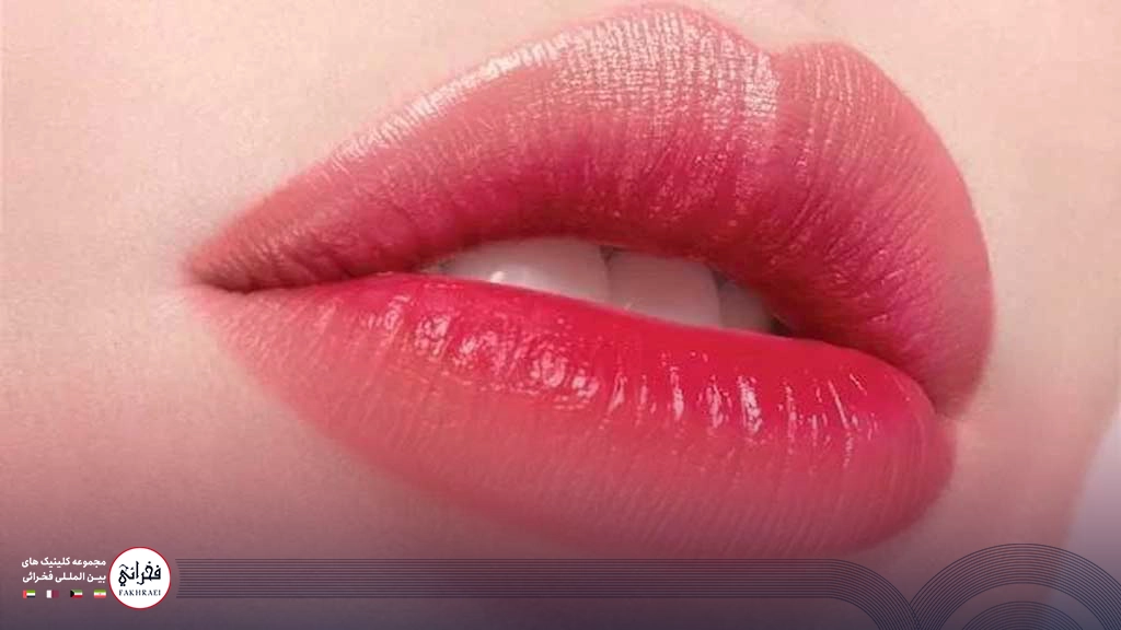 تزریق ژل لب قلبی -لب های صورتی خانمی