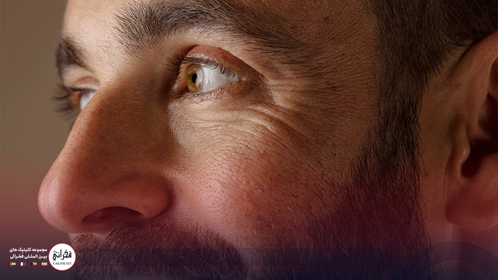 کاشت ابرو مردانه-مردی با ابرو پرپشت