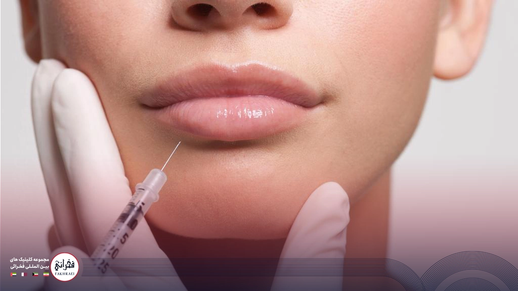 یک خانم در حال دریافت پروتز لب روسی توسط پزشک