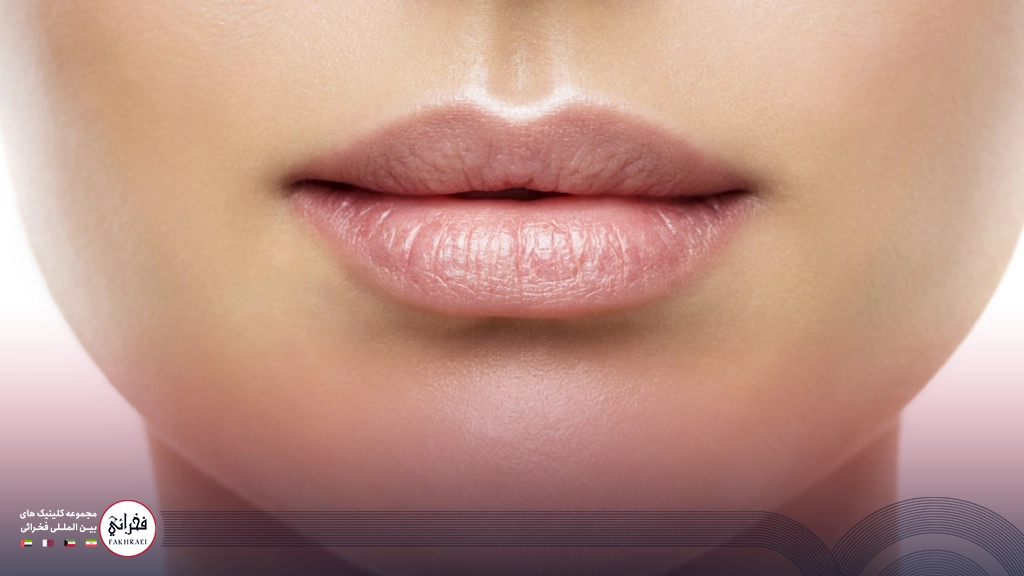 تزریق ژل لب مدل گرد-لب های ژل زده خانومی