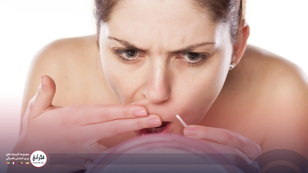 کندن موهای زائد صورت